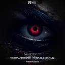 Severe Trauma - Hakka Remix by Nutty T, Hakka - Hardstyle cover art